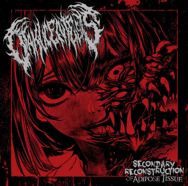 Otakucentesis : Secondary Reconstruction Of Adipose Tissue (CD, EP)