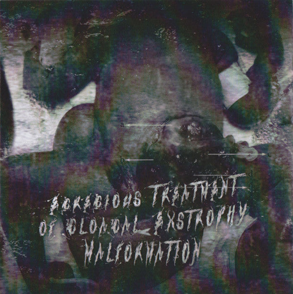 Encystment : Egregious Treatment Of Cloacal Exstrophy Malformation (CD, Album)