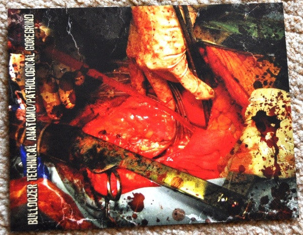 Aposepsy : Aposepsy (CD, Album)